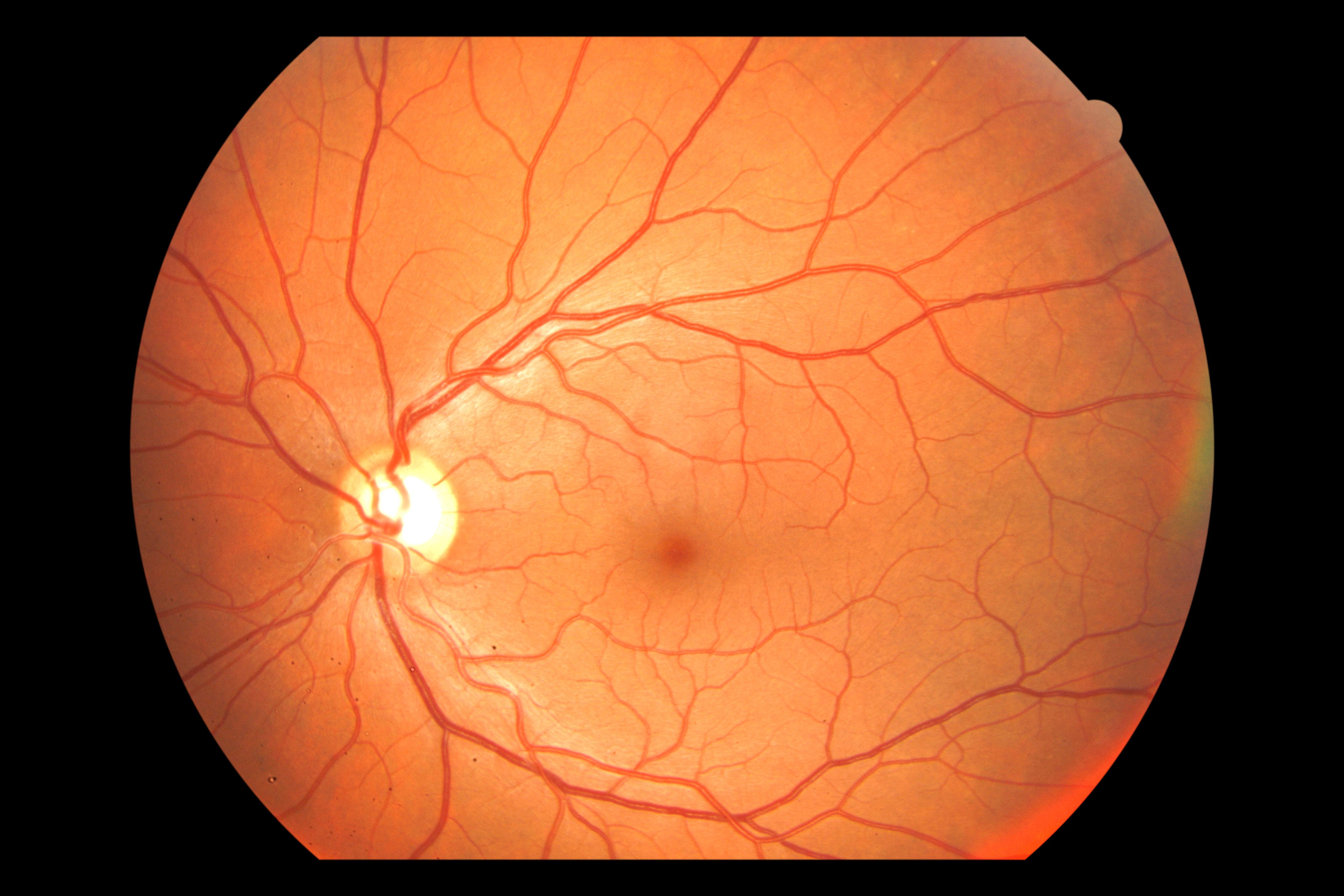 retina location and function