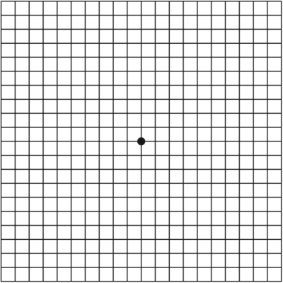 Macular Degeneration - Amsler Grid – Brisbane Retina | Dr Abhishek Sharma