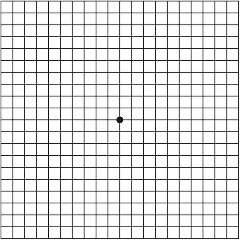 Macular Degeneration - Amsler Grid – Brisbane Retina | Dr Abhishek Sharma